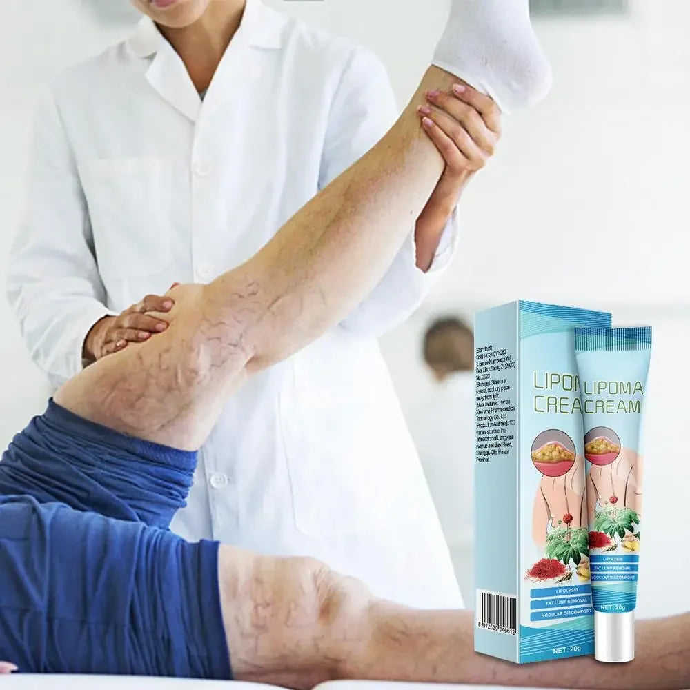 OEM Lipoma Cream 20g Portable Skin Cream Lipoma Care Lotion Multifunctional Lymphatic Ointment