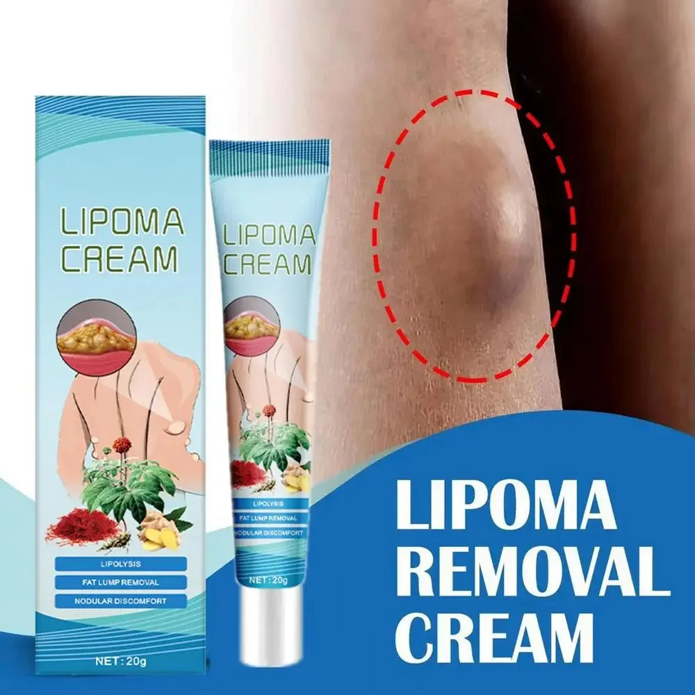 OEM Lipoma Cream 20g Portable Skin Cream Lipoma Care Lotion Multifunctional Lymphatic Ointment