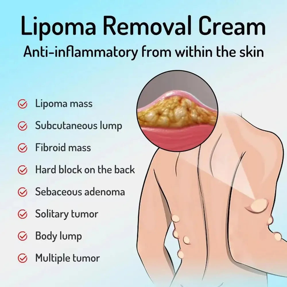 OEM Lipoma Cream 20g Portable Skin Cream Lipoma Care Lotion Multifunctional Lymphatic Ointment