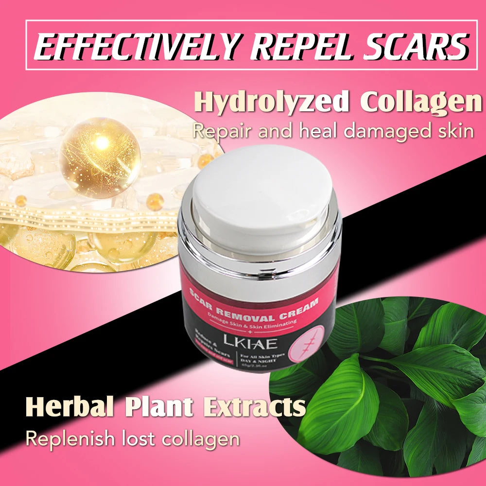 Strong Effective Acne Scar Removal Cream Smoothing Firming New Scars Stretch Marks Pimples Cream
